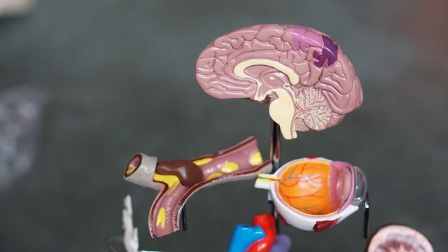 סטרוק, פקקת, שבץ, איסכמי, המורגי, כריש דם